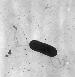 Listeria Listeria