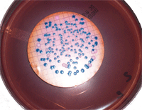 Bacteria identification